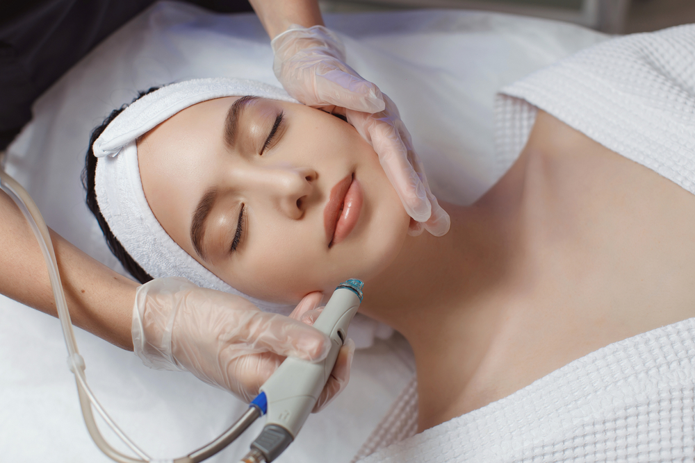 HydraFacial Good for Acne in Vienna