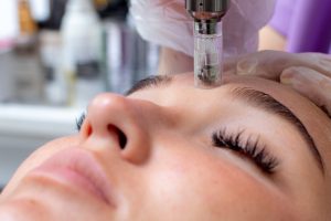 How Much Is Microneedling in Rockville