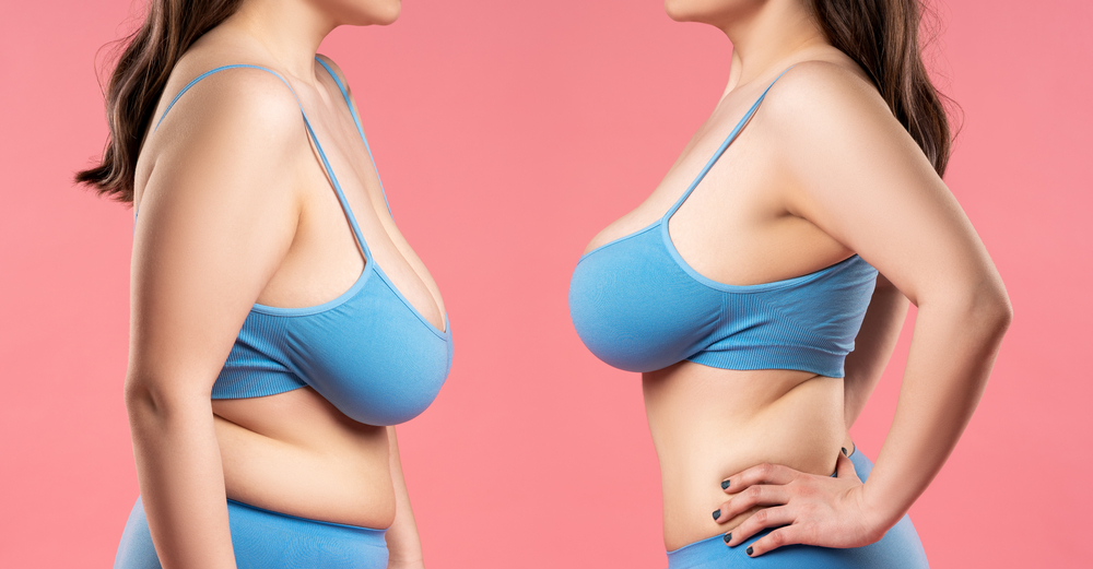 Breast Lift Specialist