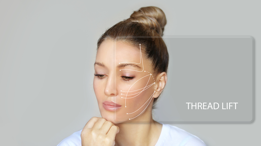 8 Benefits of the Best Thread Lift in McLean, Virginia Younger Image