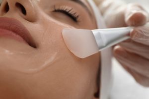 Best Chemical Peels in Tysons Corner