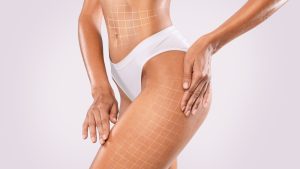 Here’s the Secret to the Best 360 Liposuction in Tysons Corner, Virginia
