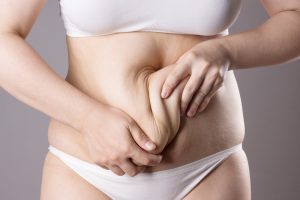 Tummy Tuck Consultation in McLean