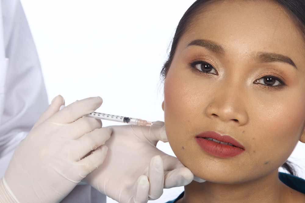 Jawline Filler in Rockville, Maryland & Vienna, Virginia