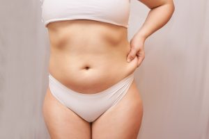 How Much Weight Can You Lose From Liposuction in Washington DC?