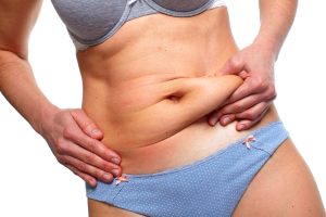 How Much Does a Tummy Tuck Cost in Fairfax