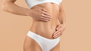 Get the Tummy Tuck Cost in Reston