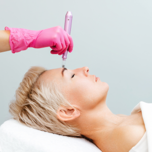 Microneedling Results in Merrifield