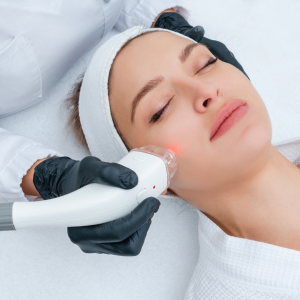 Morpheus8 Cost in Vienna Virginia