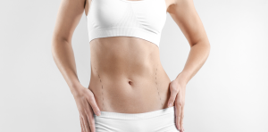 Liposuction Cost in Northern Virginia