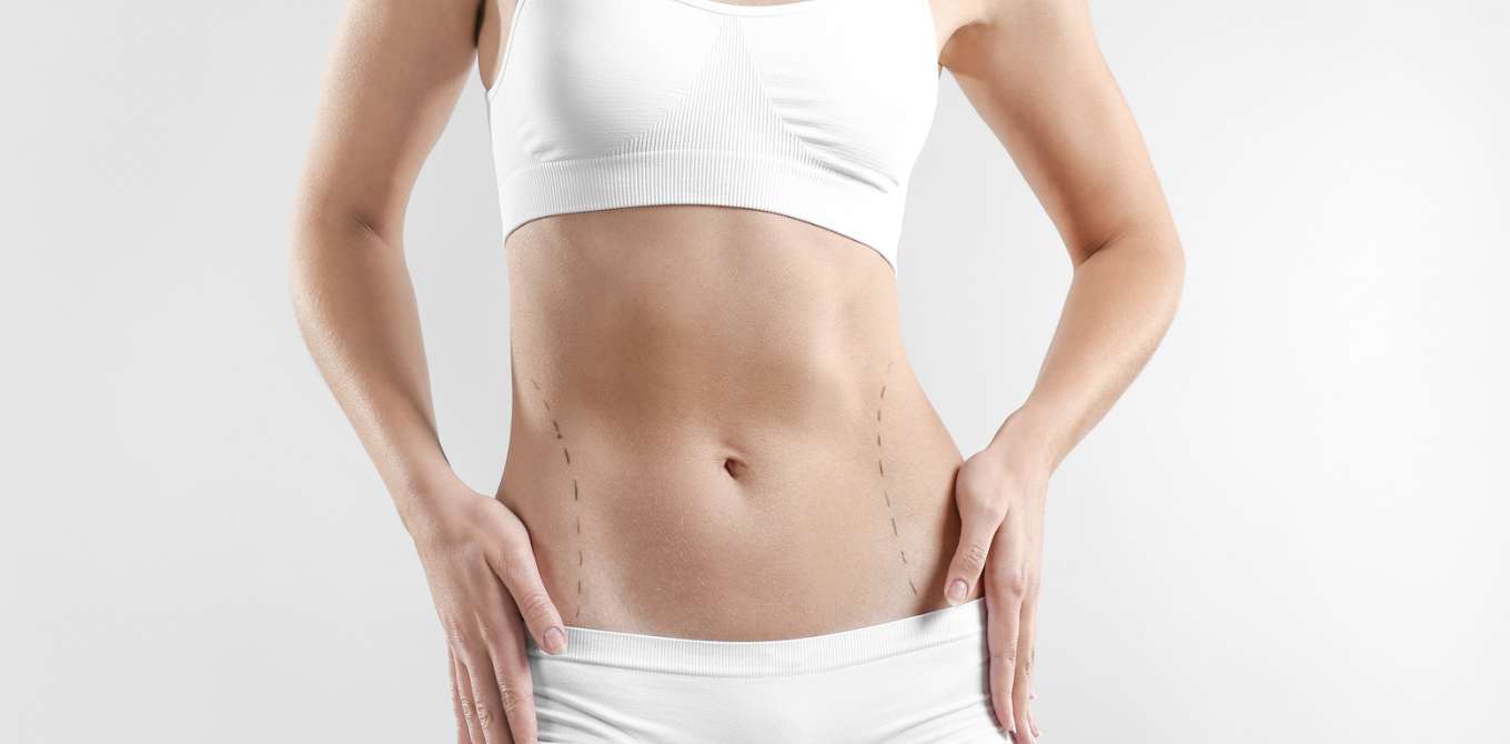 Liposuction Cost in Northern Virginia