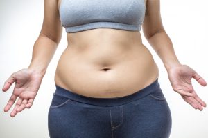 Find the Top Liposuction Doctor in Virginia