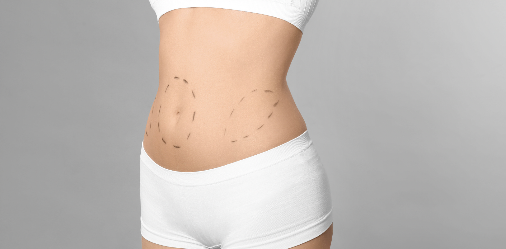 Affordable Liposuction in Arlington