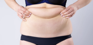 Mini vs Full Tummy Tuck Pricing in Reston