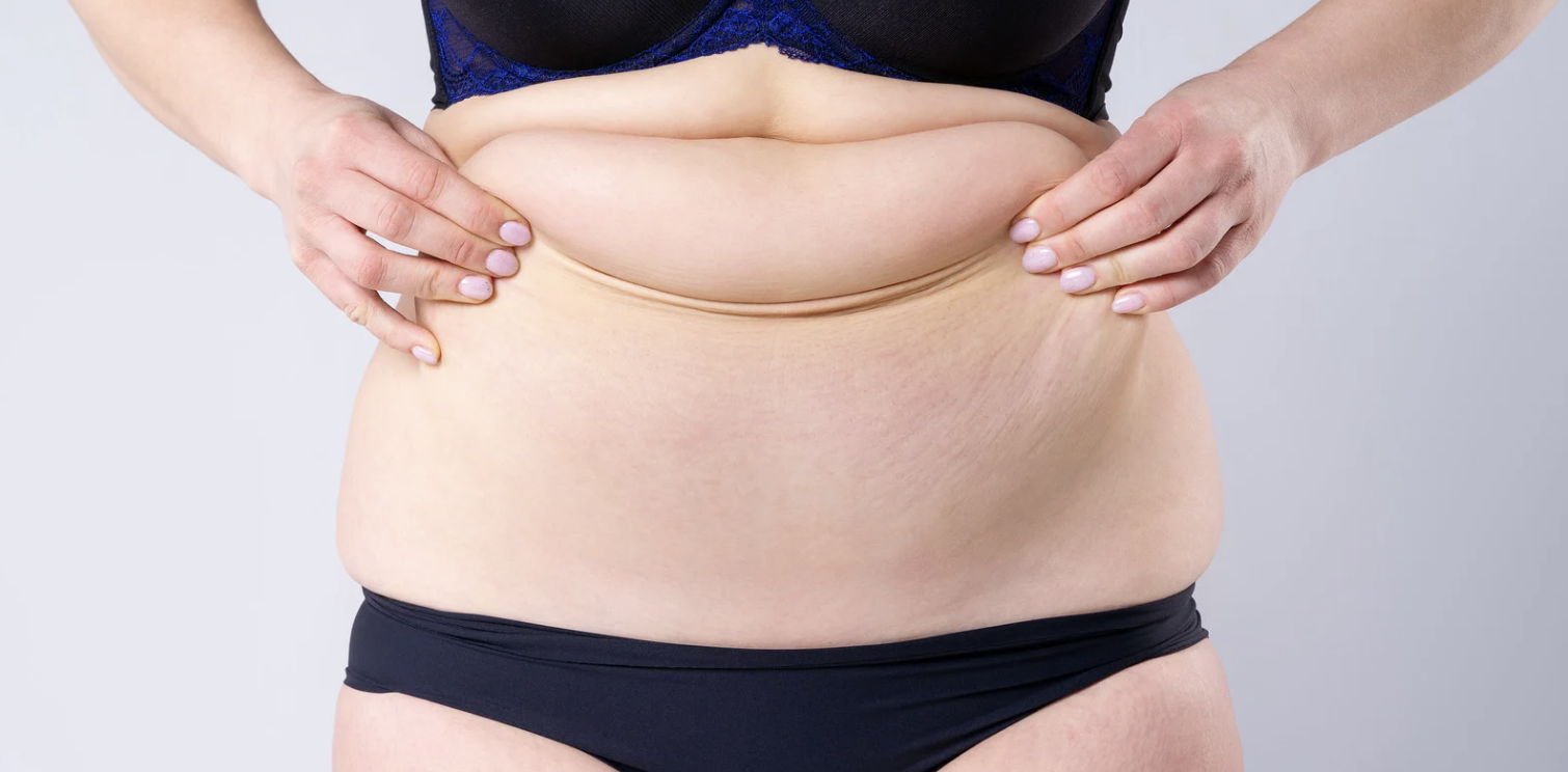 Mini vs Full Tummy Tuck Pricing in Reston