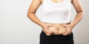 Best Tummy Tuck Pricing in Northern VA