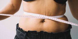 Tummy Tuck Cost and Recovery Near Tysons VA