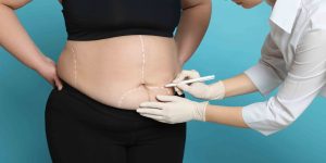 Best Tummy Tuck Prices and Types Near Woodbridge VA