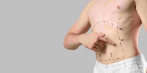 Liposuction Appointment Availability in Maryland