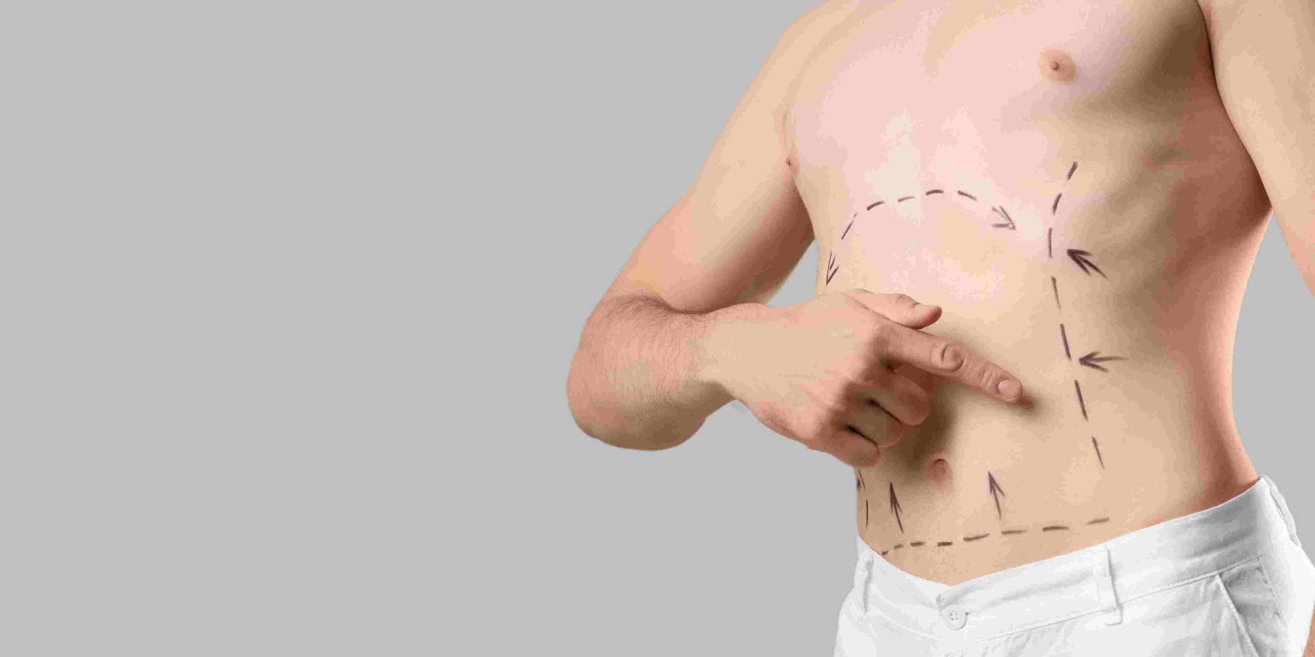 Liposuction Appointment Availability in Maryland
