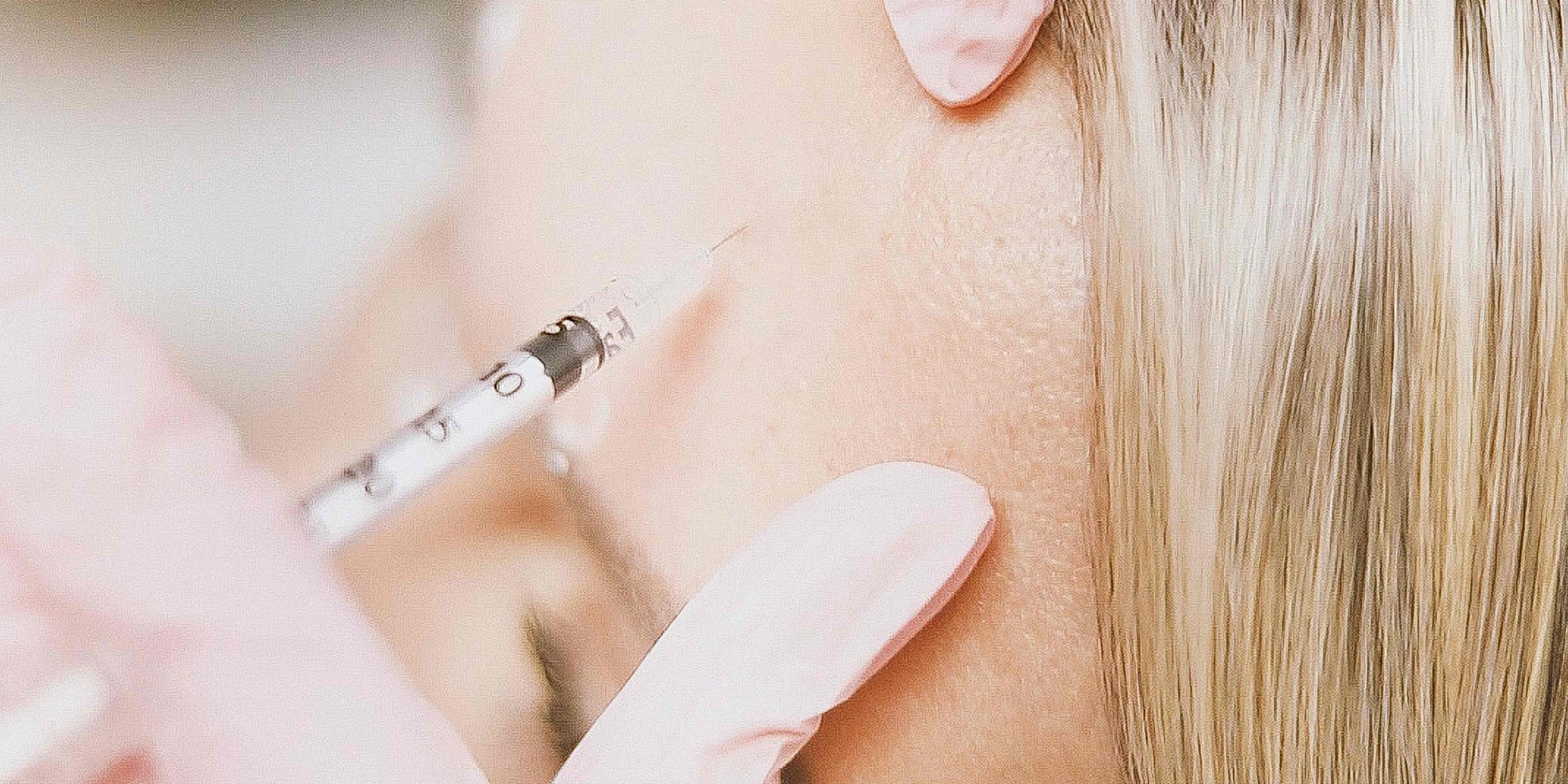 Botox Appointment for Forehead Lines in Vienna Virginia