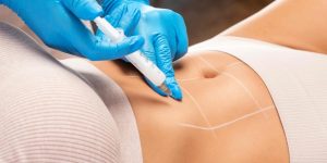 Weight Loss Injection Doctor Visit in Arlington Virginia