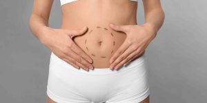 Mini vs. Full Tummy Tuck Pricing in Falls Church Virginia