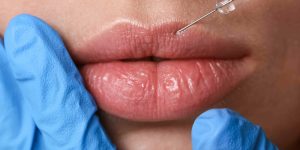 Lip Filler Prices in Northern Virginia