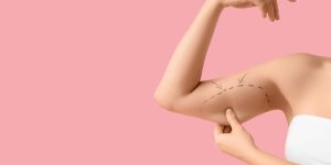 Liposuction Savings Tips in Northern Virginia