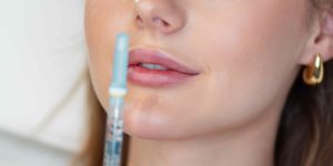 Dermal Filler Treatments for Facial Balancing in Vienna Virginia