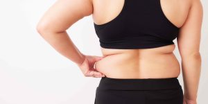 Liposuction Surgery in Washington DC