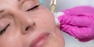 Cheek Filler Near McLean VA