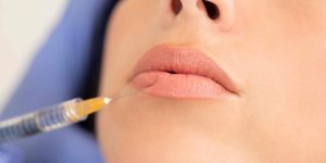 Lip Injections Near McLean VA
