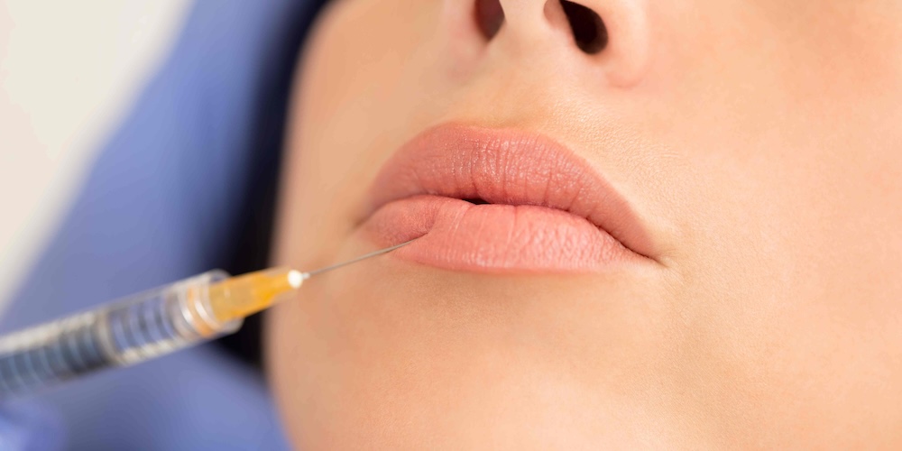 Lip Injections Near McLean VA