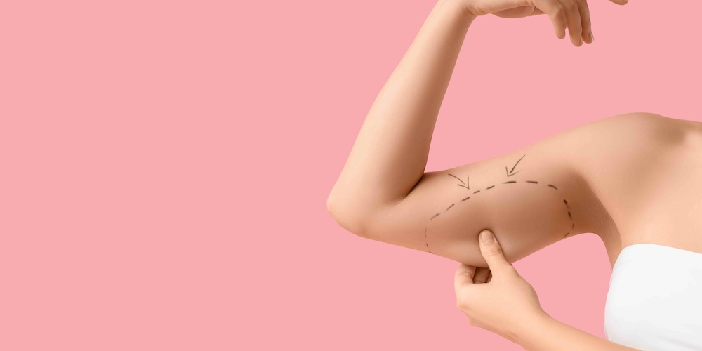 Cheapest Liposuction Options in Tysons Corner VA