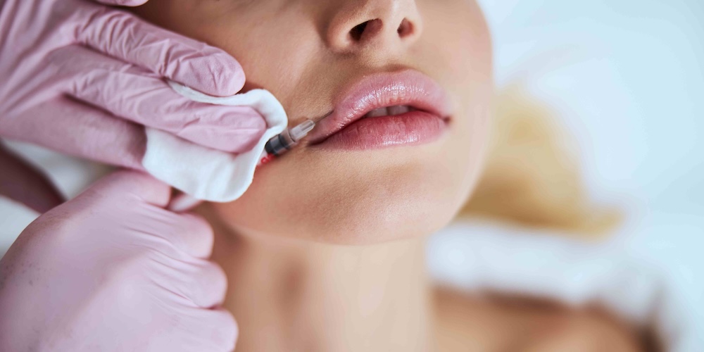 Lip Filler Consultations in Vienna VA