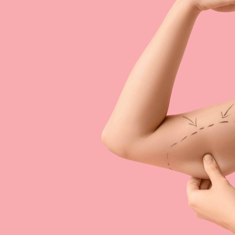Cheapest Liposuction Options in Tysons Corner VA