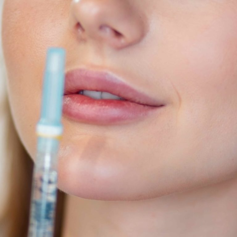 Dermal Filler Treatments for Facial Balancing in Vienna Virginia
