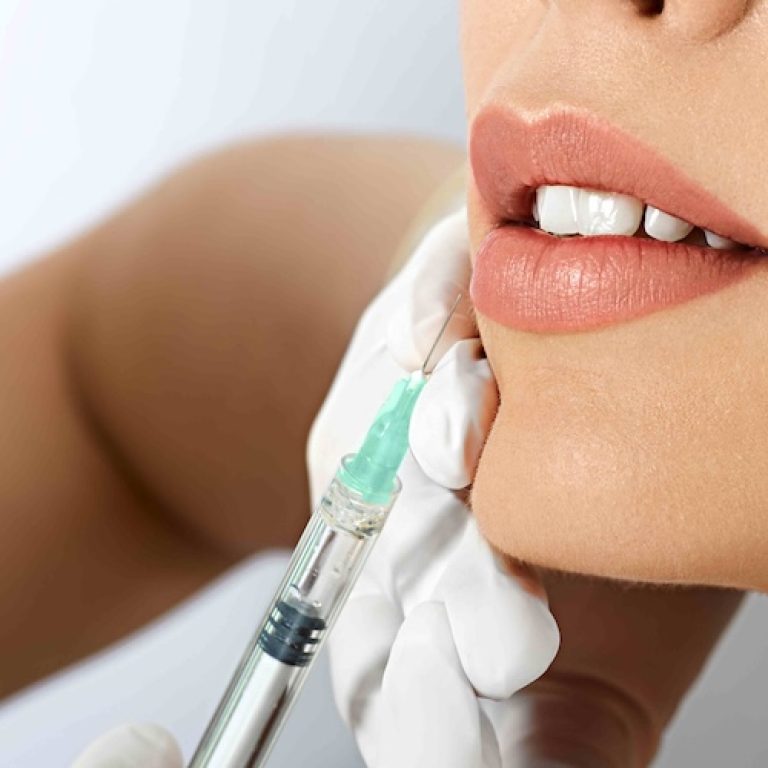 Same-Day Lip Filler Appointments in Vienna VA