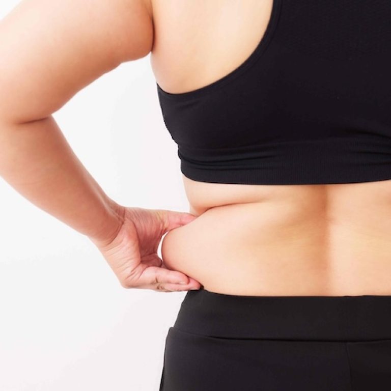 Liposuction Surgery in Washington DC