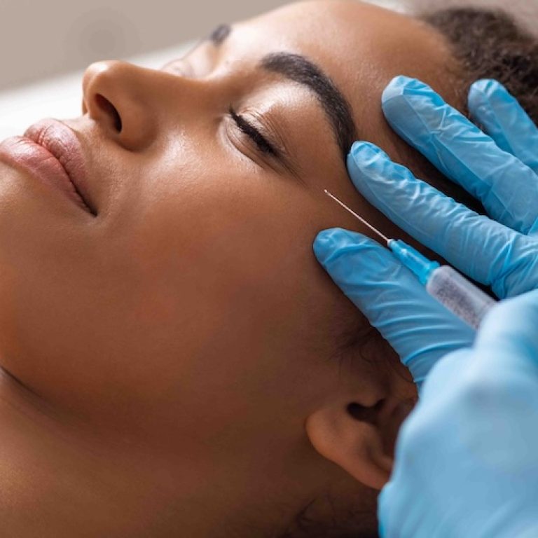 Under Eye Filler in Vienna VA