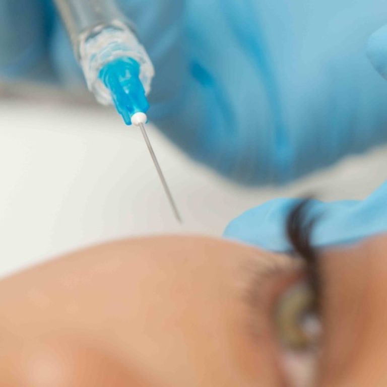 Under Eye Filler Pricing in Vienna VA