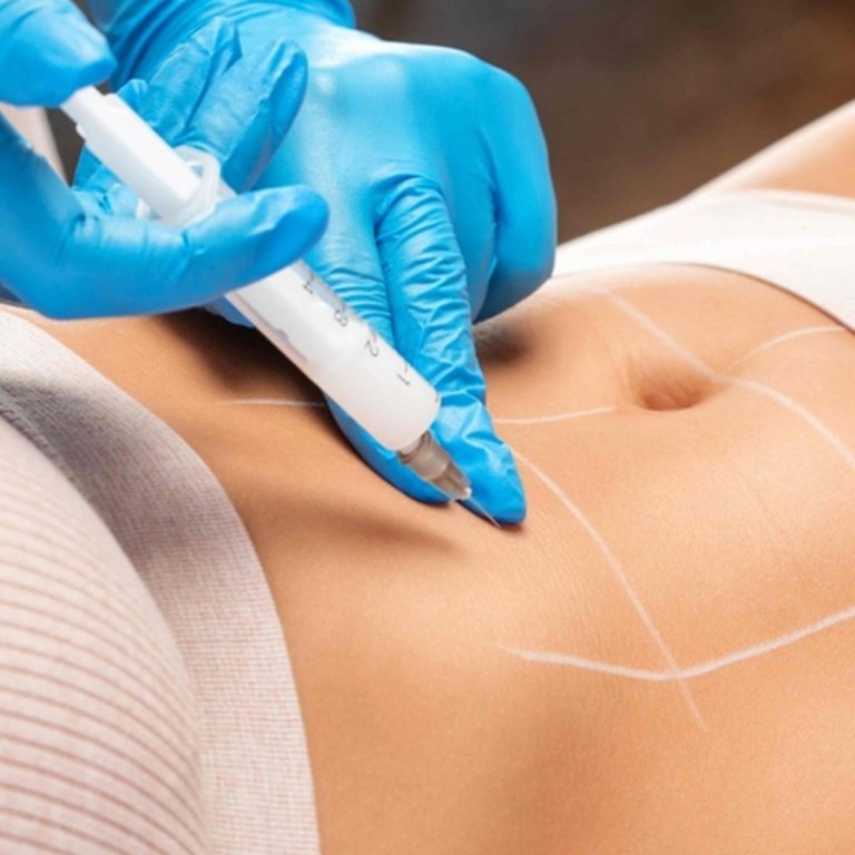 Weight Loss Injection Doctor Visit in Arlington Virginia