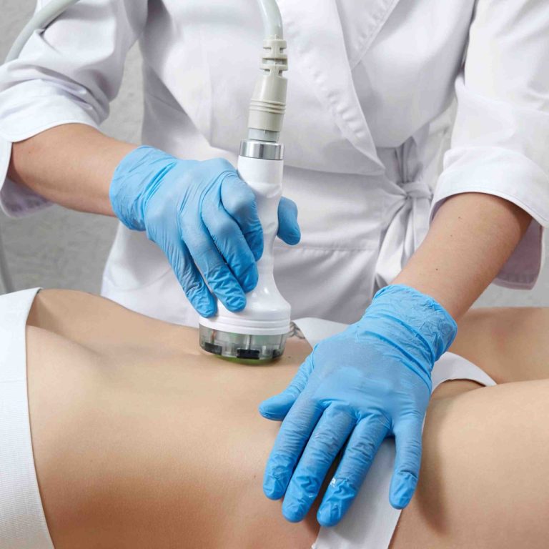 Non-Invasive Stomach Tightening Treatments for Loose Skin Near McLean VA