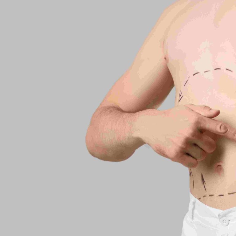Liposuction Appointment Availability in Maryland