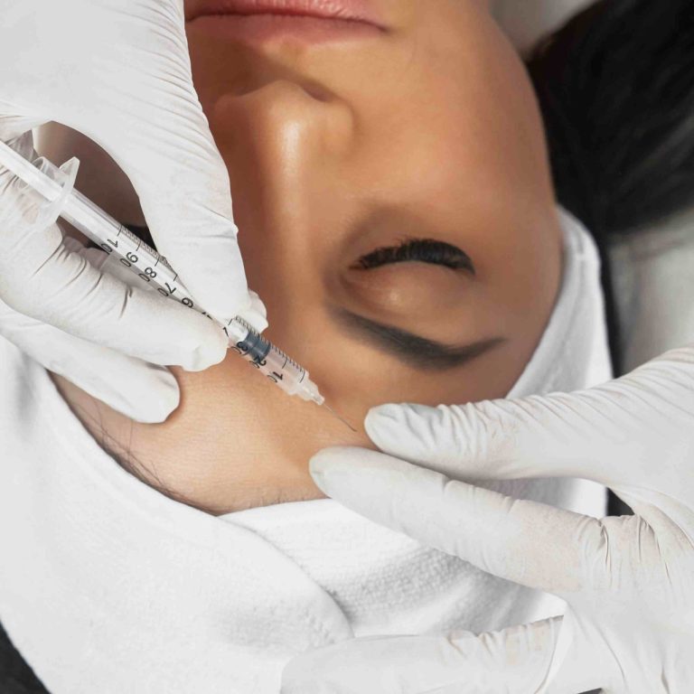 Botox Appointment for Forehead and Crow’s Feet in Vienna VA