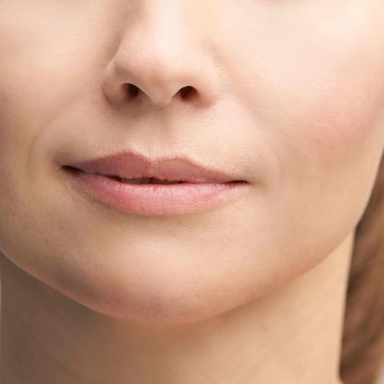 Botox And Filler Combo Near McLean VA