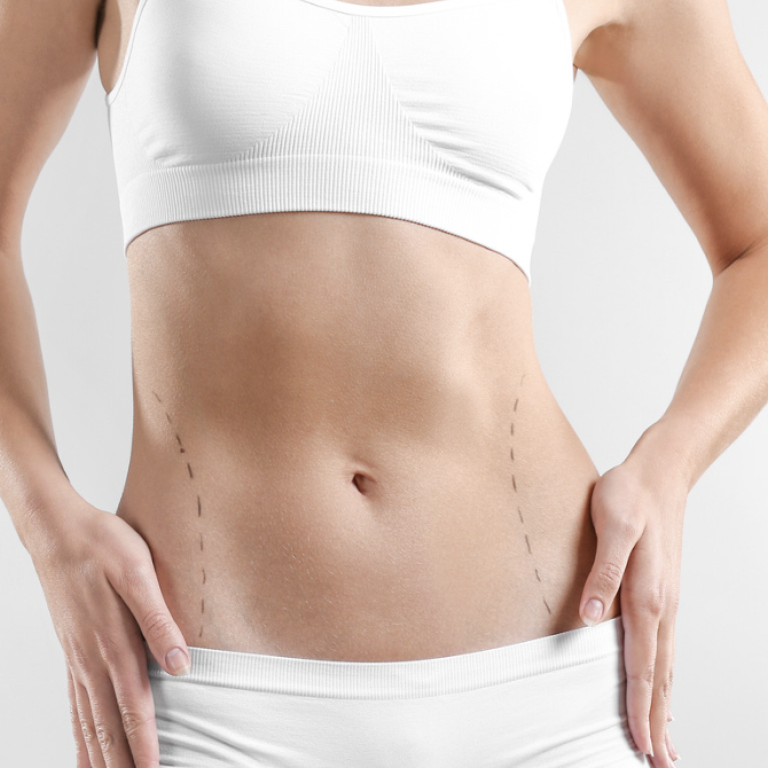 Liposuction Cost in Northern Virginia
