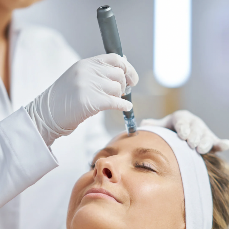 Morpheus8 RF Microneedling