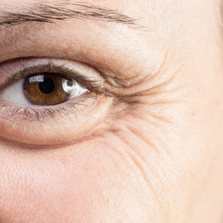Get Baby Botox in Vienna